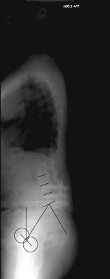 Adulte Def. I Adulte Def. I